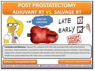 PROSTATE CANCER POST OP RADIOTHERAPY | PPTX