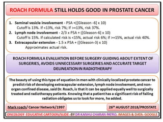 PROSTATE CANCER POST OP RADIOTHERAPY | PPTX