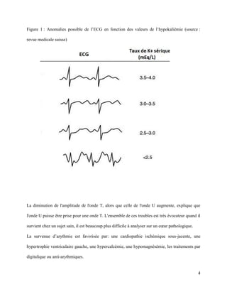 4
Figure 1 : Anomalies possible de l’ECG en fonction des valeurs de l’hypokaliémie (source :
revue medicale suisse)
La diminution de l'amplitude de l'onde T, alors que celle de l'onde U augmente, explique que
l'onde U puisse être prise pour une onde T. L'ensemble de ces troubles est très évocateur quand il
survient chez un sujet sain, il est beaucoup plus difficile à analyser sur un cœur pathologique.
La survenue d’arythmie est favorisée par: une cardiopathie ischémique sous-jacente, une
hypertrophie ventriculaire gauche, une hypercalcémie, une hypomagnésémie, les traitements par
digitalique ou anti-arythmiques.
 