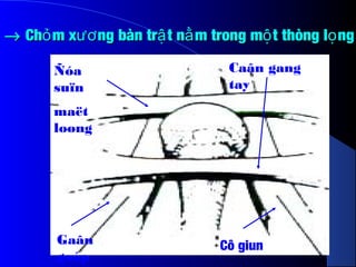 →→ Ch m x ng bàn tr t n m trong m t thòng l ngỏ ươ ậ ằ ộ ọCh m x ng bàn tr t n m trong m t thòng l ngỏ ươ ậ ằ ộ ọ
Ñóa
suïn
maët
loøng
Gaân
gaáp
Cô giun
Caân gang
tay
 
