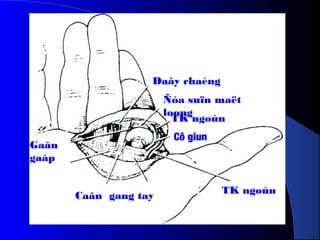 TK ngoùn
Daây chaèng
Caân gang tay
Gaân
gaáp
Ñóa suïn maët
loøng
TK ngoùn
Cô giun
 