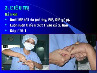 2. I U TRĐ Ề Ị2. I U TRĐ Ề Ị
N n kínắ
 Du i MP t i a (c tay, PIP, DIP g p).ỗ ố đ ổ ậ
 Luôn luôn tì n n t 1 vào c x. bànề đố ổ
 G p t 1ậ đố
 
