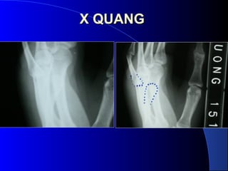 X QUANGX QUANG
 