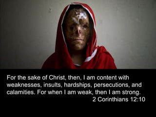 For the sake of Christ, then, I am content with weaknesses, insults, hardships, persecutions, and calamities. For when I am weak, then I am strong. 											2 Corinthians 12:10