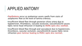 APPLIED ANTOMY
Papilledema occur as prelaminar axons swells from statis of
axoplasmic flow at the level of lamina cribrosa.
Insufficient blood flow through posterior ciliary artery due to
hypotension, thrombosis, vascular occlusion, vasculitis(GCA) causes
Optic nerve head infraction in leading to AION( optic disc swelled).
Insufficient blood flow through pial vasculature due to hypotension,
thrombosis, vascular occlution, vasculitis(GCA) causes Optic nerve
infraction post-laminar leading to PION ( optic disc normal).
 