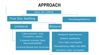 APPROACH
Optic disc selling
True Disc Swelling
Unilateral
1.Demyelinating : MS
2.Neuroretinitis: Viral,
Toxoplama, syphilis
3.Anterior Ischemic Optic
Neuropathy(AION)
4.Central Retinal Vein Occlusion
5.Compressive optic neuropathy
Bilateral
Papilledema
Malignant Hypertension
Diabetic papillpathy
Toxic Optic neuropathy
Demyelinating :NMO, Anti MOG
Hereditary optic neuropathy
Pseudopapilledema
 