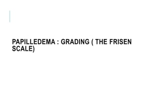 PAPILLEDEMA : GRADING ( THE FRISEN
SCALE)
 