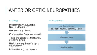 ANTERIOR OPTIC NEUROPATHIES
Etiology
Inflammatory .e.g.Optic
Neuritis(Papillitis)
Ischemic .e.g. AION
Compressive Optic neuropathy
Toxin induced.e.g. Methanol,
ethelene glycol
Heriditary.e.g. Leber’s optic
neuropathy
Infiltrative.e.g. sarcoisosis
Pathogenesis
Optic Disc Swelling
Inflammatory change
Local Optic nerve injury
e.g. Optic neuritis, Ischemia, Toxins
 