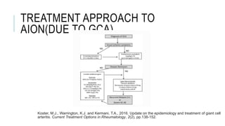 TREATMENT APPROACH TO
AION(DUE TO GCA)
Koster, M.J., Warrington, K.J. and Kermani, T.A., 2016. Update on the epidemiology and treatment of giant cell
arteritis. Current Treatment Options in Rheumatology, 2(2), pp.138-152.
 