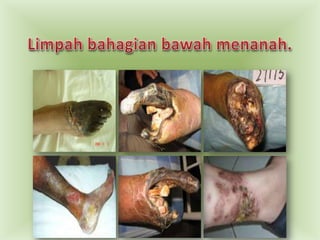 Limpahbahagianbawahmenanah.