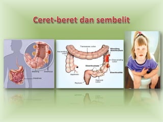 Ceret-beret dansembelit