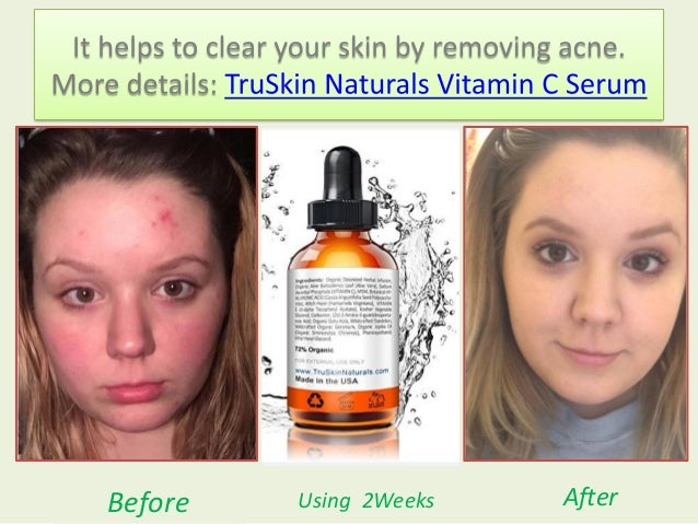 true skin serum c