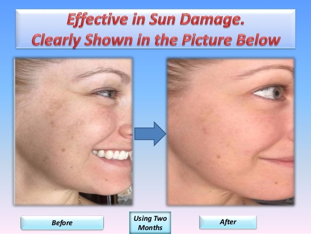 true skin serum c