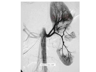 Bradley R. Davis, USAF  