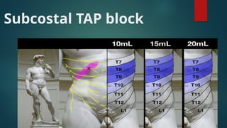 Tap Block Types truncal block , Abdominal wall blocks.pptx
