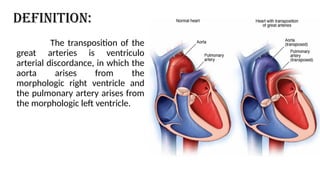 DEFINITION:
The transposition of the
great arteries is ventriculo
arterial discordance, in which the
aorta arises from the
morphologic right ventricle and
the pulmonary artery arises from
the morphologic left ventricle.
 