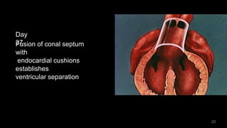 Day
37Fusion of conal septum
with
endocardial cushions
establishes
ventricular separation
20
 