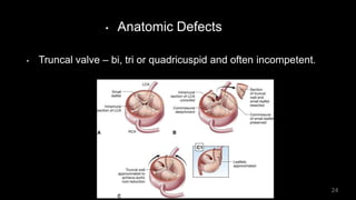 • Anatomic Defects
• Truncal valve – bi, tri or quadricuspid and often incompetent.
24
 