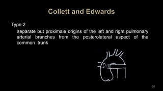 Type 2
separate but proximale origins of the left and right pulmonary
arterial branches from the posterolateral aspect of the
common trunk
30
 