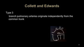Type 3
branch pulmonary arteries originate independently from the
common trunk
32
 