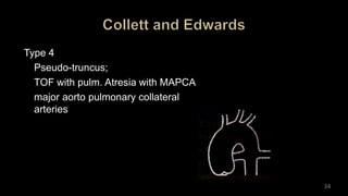 Type 4
Pseudo-truncus;
TOF with pulm. Atresia with MAPCA
major aorto pulmonary collateral
arteries
34
 