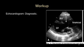 Echocardiogram: Diagnostic.
65
 