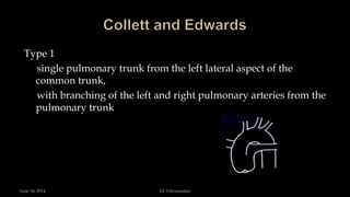 Type 1
single pulmonary trunk from the left lateral aspect of the
common trunk,
with branching of the left and right pulmonary arteries from the
pulmonary trunk
June 10, 2014 Dr S.Sivasankar
 