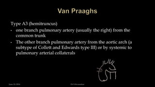 Type A3 (hemitruncus)
• one branch pulmonary artery (usually the right) from the
common trunk
• The other branch pulmonary artery from the aortic arch (a
subtype of Collett and Edwards type III) or by systemic to
pulmonary arterial collaterals
June 10, 2014 Dr S.Sivasankar
 