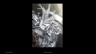 June 10, 2014 Dr S.Sivasankar
 