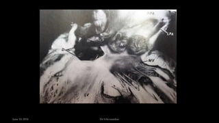 June 10, 2014 Dr S.Sivasankar
 