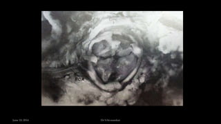 June 10, 2014 Dr S.Sivasankar
 