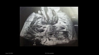 June 10, 2014 Dr S.Sivasankar
 