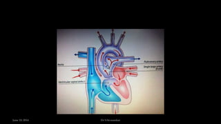 June 10, 2014 Dr S.Sivasankar
 