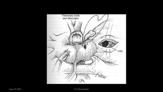 June 10, 2014 Dr S.Sivasankar
 