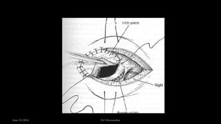 June 10, 2014 Dr S.Sivasankar
 