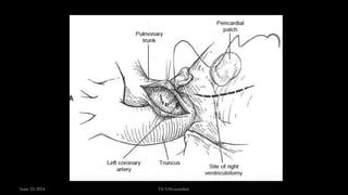 June 10, 2014 Dr S.Sivasankar
 