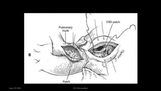 June 10, 2014 Dr S.Sivasankar
 
