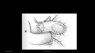 June 10, 2014 Dr S.Sivasankar
 
