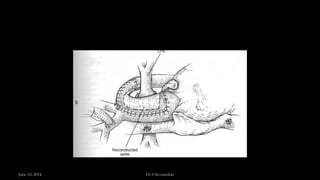 June 10, 2014 Dr S.Sivasankar
 