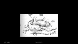 June 10, 2014 Dr S.Sivasankar
 