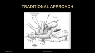 June 10, 2014 Dr S.Sivasankar
 