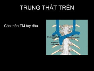 TRUNG THẤT TRÊN
Các thân TM tay đầu
 
