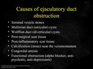 Causes of ejaculatory duct obstruction ,[object Object],[object Object],[object Object],[object Object],[object Object],[object Object],[object Object],[object Object]
