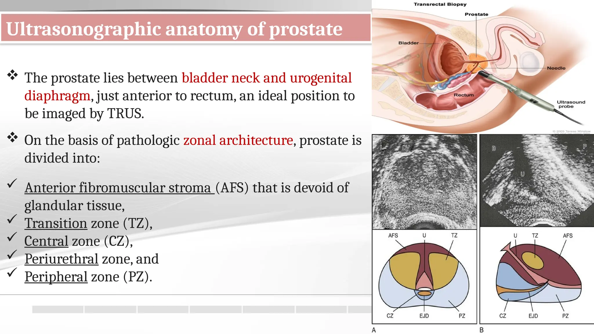 Prostrate Position Trans rectal ultrasound and biopsy .pptx