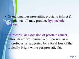 Powerpoint Templates
Page 20
• Granulomatous prostatitis, prostatic infarct &
lymphoma- all may produce hypoechoic
lesions.
• Extracapsular extension of prostate cancer,
although not well visualized if present as a
microfocus, is suggested by a focal loss of the
typically bright white periprostatic fat.
 