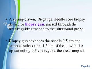 Powerpoint Templates
Page 39
• A spring-driven, 18-gauge, needle core biopsy
device or biopsy gun, passed through the
needle guide attached to the ultrasound probe.
• Biopsy gun advances the needle 0.5 cm and
samples subsequent 1.5 cm of tissue with the
tip extending 0.5 cm beyond the area sampled.
 