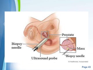 Powerpoint Templates
Page 43
 