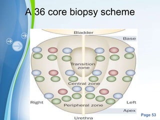 Powerpoint Templates
Page 53
A 36 core biopsy scheme
 