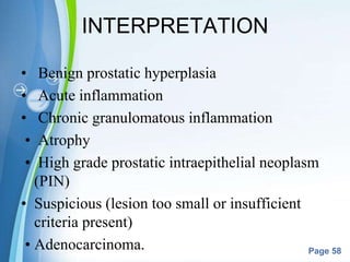 Powerpoint Templates
Page 58
INTERPRETATION
• Benign prostatic hyperplasia
• Acute inflammation
• Chronic granulomatous inflammation
• Atrophy
• High grade prostatic intraepithelial neoplasm
(PIN)
• Suspicious (lesion too small or insufficient
criteria present)
• Adenocarcinoma.
 