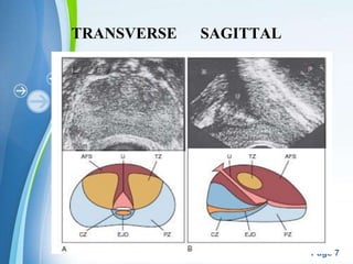 Powerpoint Templates
Page 7
TRANSVERSE SAGITTAL
 